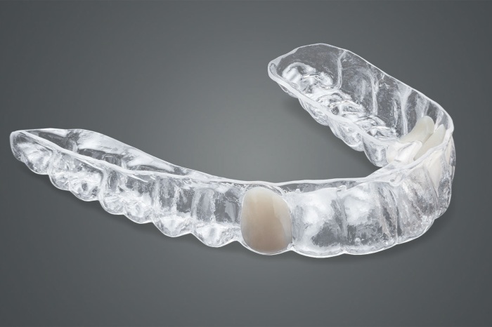 Essix Retainers