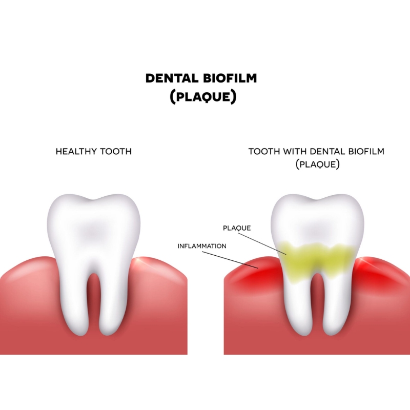 Dental Plaque Microscopic Image