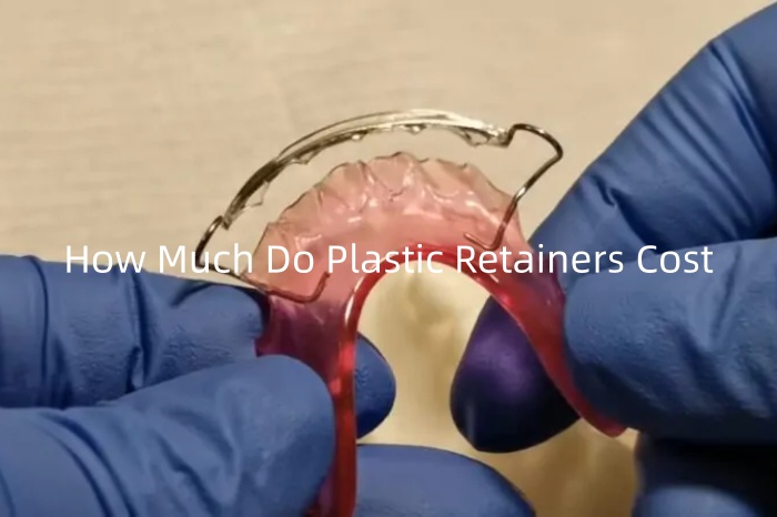 How Much Do Plastic Retainers Cost