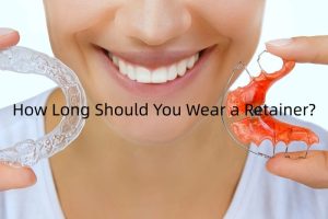 How long wear a retainer